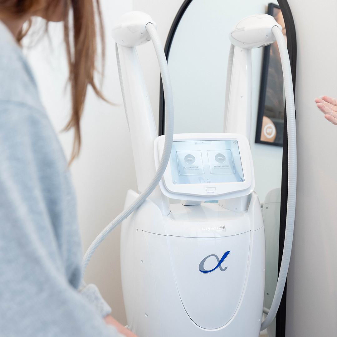 12 Months of Fat Freezing