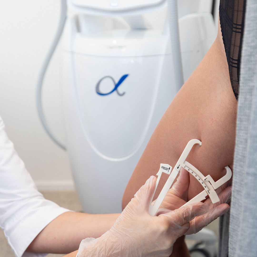 12 Months of Fat Freezing