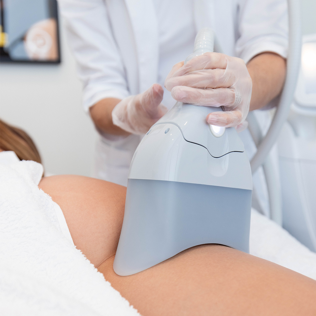 12 Months of Fat Freezing